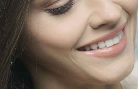 fundas-dentales Fundas dentales de aspecto natural en Madrid