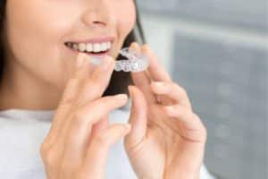Beneficios después de la ortodoncia 