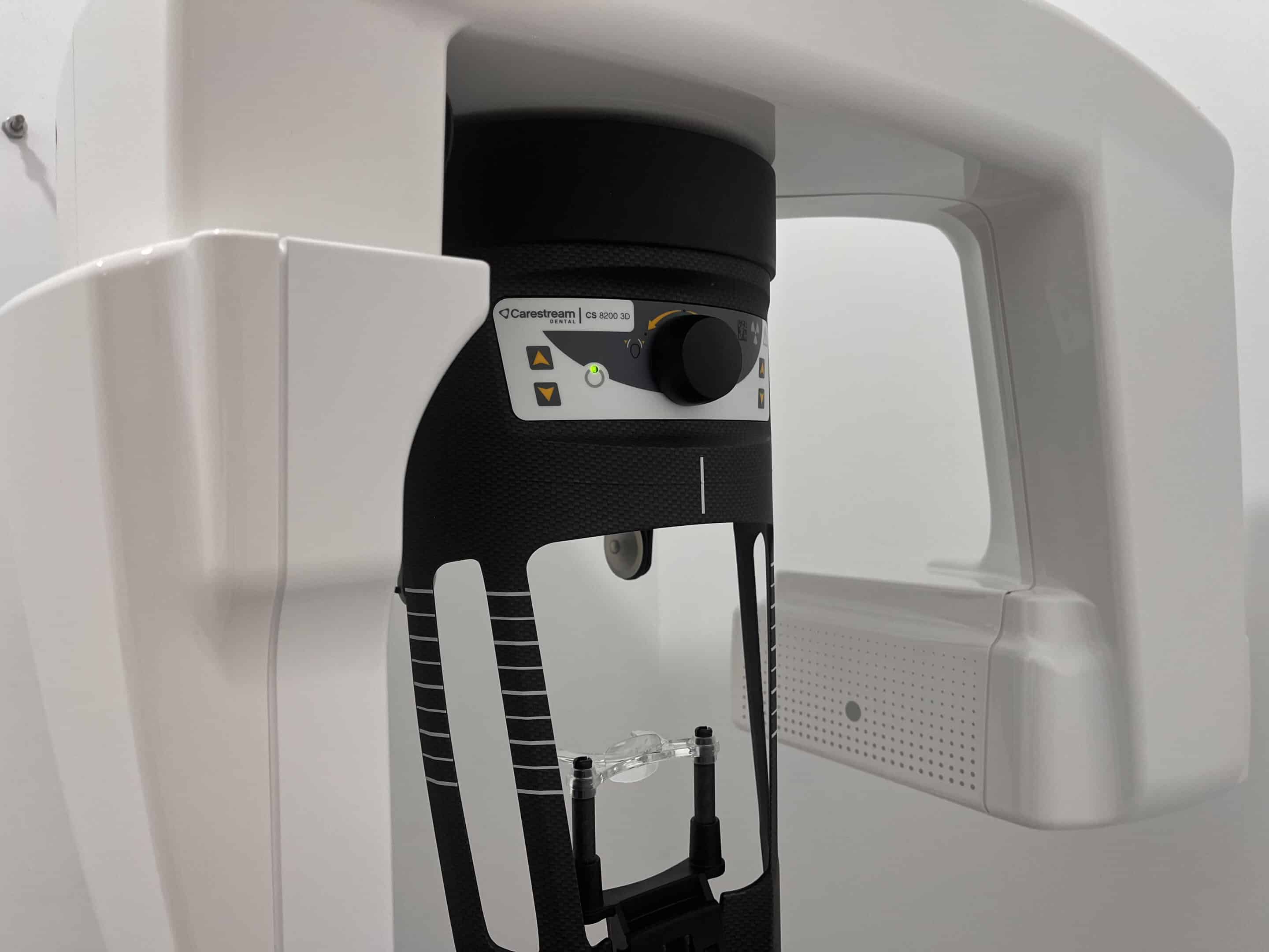TAC dental 3D con el que se localizan los quistes maxilares