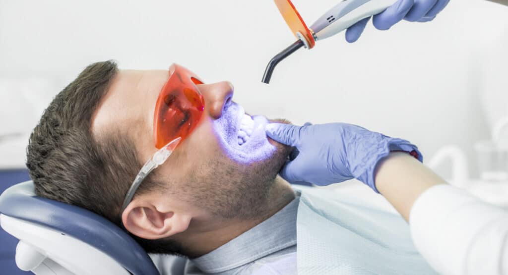 Blanqueamiento dental sin sensibilidad en madrid
