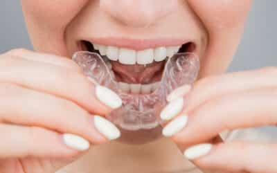 La importancia de los retenedores dentales en la ortodoncia