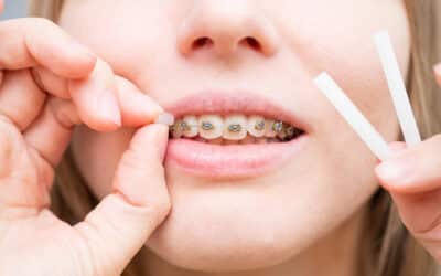 Cera dental: qué es y cómo se usa