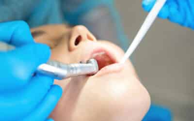 Puente dental: sobre dientes naturales o sobre implantes