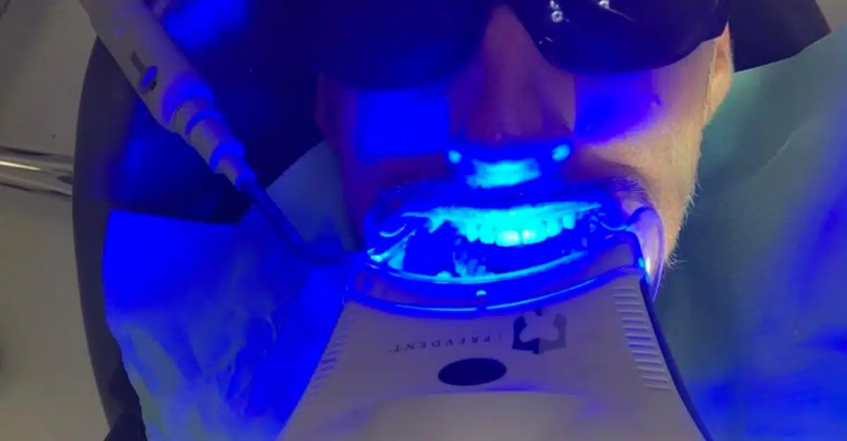 Blanqueamiento dental en Madrid. Salud Dental Blanco. Blanqueamiento dental en Madrid. Salud Dental Blanco.