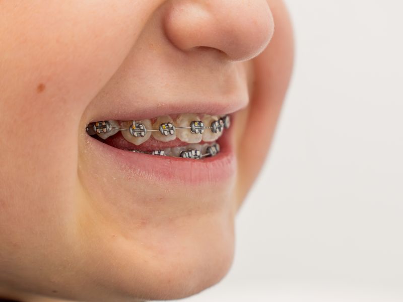 Dentista infantil en Madrid revisando a un niño