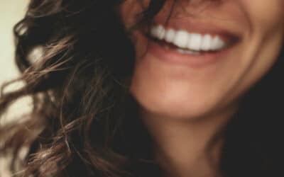 Blanqueamiento dental casero vs profesional