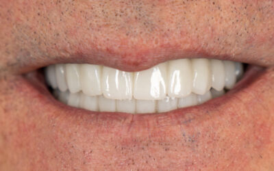 Nombres de los dientes: tipos, funciones y partes de cada pieza