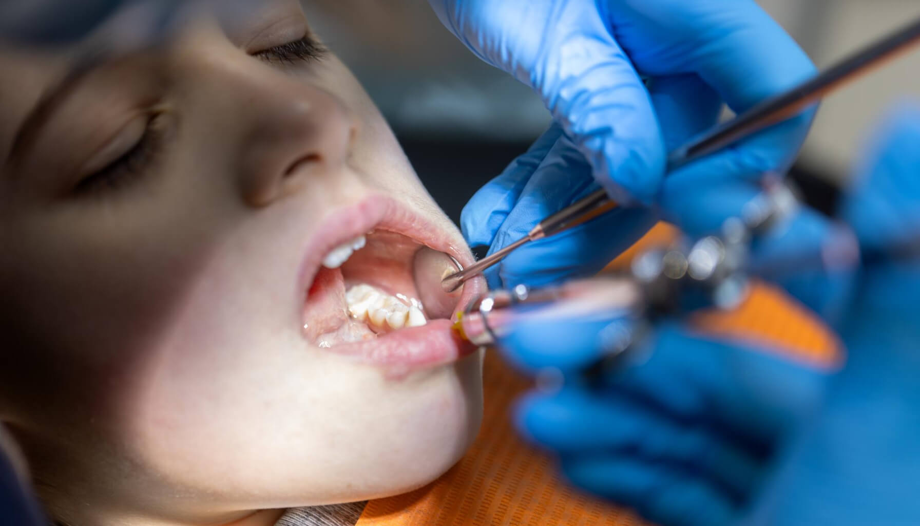 como se si tengo caries como se si tengo caries