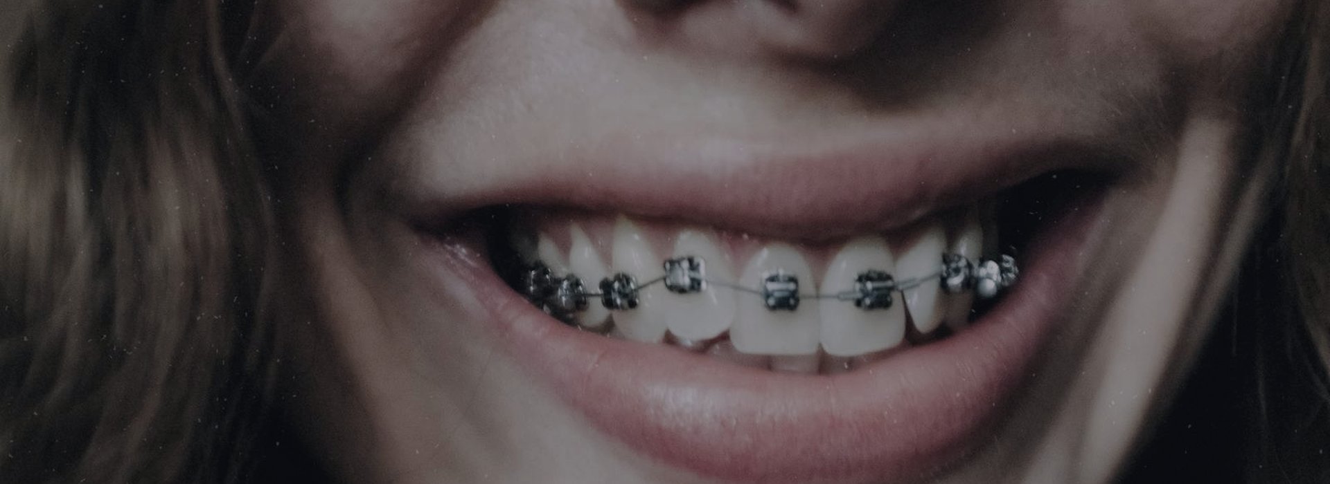 Ortodoncia en Salud Dental Blanco
