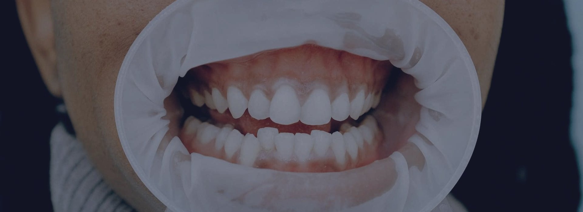 Odontología general en Salud Dental Blanco