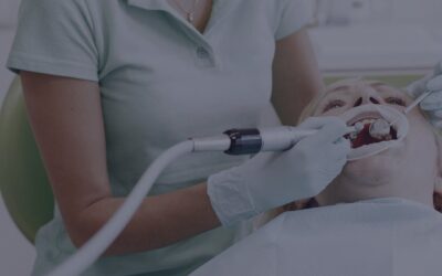 Sarro en los dientes: por qué se forma y cómo eliminarlo de verdad