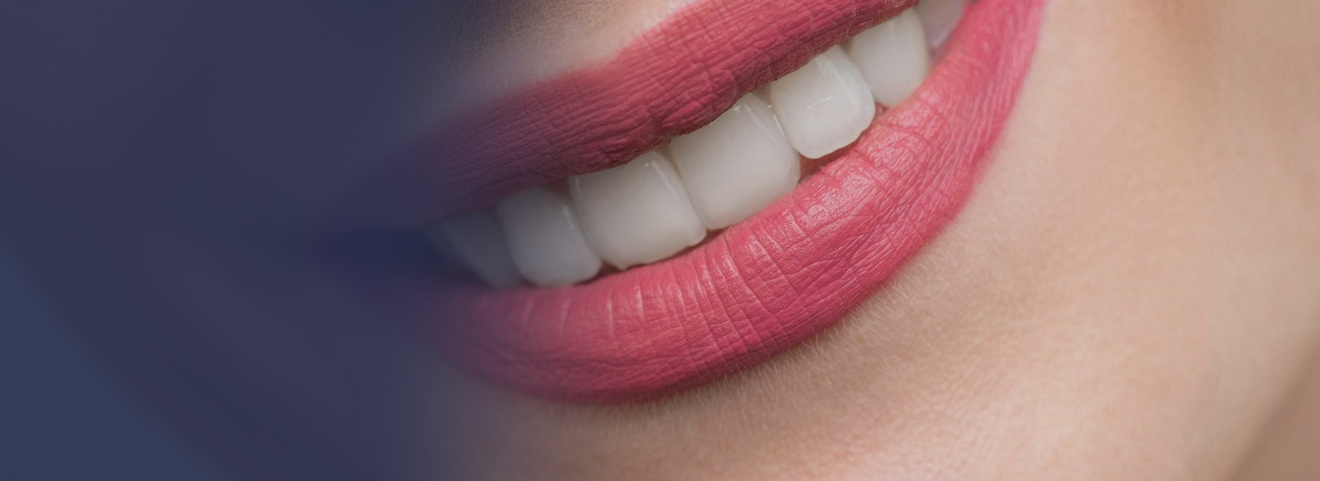 Aumento de labios en Madrid