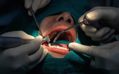 6 claves para afrontar una cirugía oral con garantías