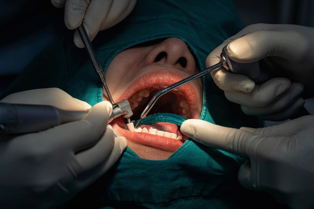 Imagen-cirugia-oral